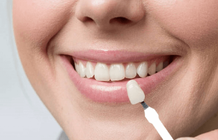woman's mouth to check veneer of tooth crown